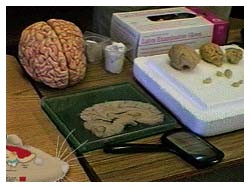 Dimensioni e forma del Cervello