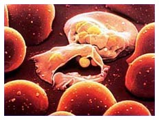 Resistenza della malaria: Plasmodium falciparum