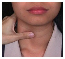 Tiroide e ormoni tiroidei: a volte se ne abusa