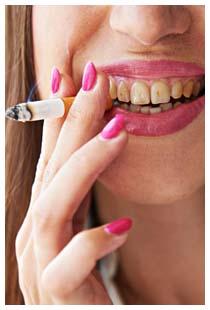 Denti gialli a causa del fumo di sigaretta