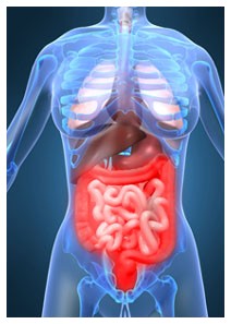 Diverticolite