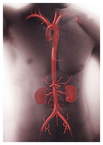 Ipertensione arteriosa Ipertensione arteriosa
