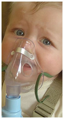 Bronchiolite nel neonato e fumo passivo Bronchiolite nel neonato e fumo passivo