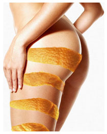 Combattere la cellulite: rimedi