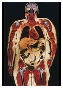 Hippo fat: misura del grasso viscerale