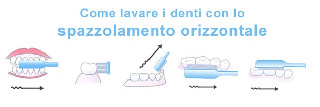 Come lavare i denti con la tecnica dello spazzolamento orizzontale Spazzolamento orizzontale per lavare i denti
