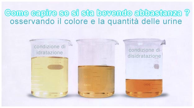 Come capire se si sta bevendo abbastanza Urnine scure e idratazione