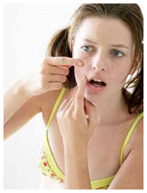 Rimedi brufoli: un vaccino anti acne Rimedi brufoli: un vaccino anti acne