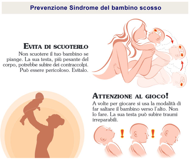 Infografica sulla Sindrome del bambino scosso Infografica sulla Sindrome del bambino scosso