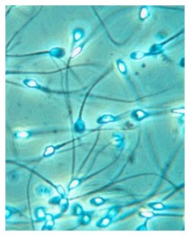 Infertilità maschile: sperimentazione di una nuova pillola (Elocalcitolo) Infertilità maschile: sperimentazione di una nuova pillola (Elocalcitolo)