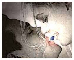 Il viagra per la donna