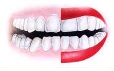 Denti bianchi per avere successo