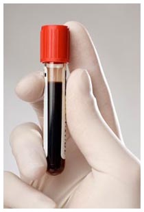 Biopsia liquida SCED per le neoplasie