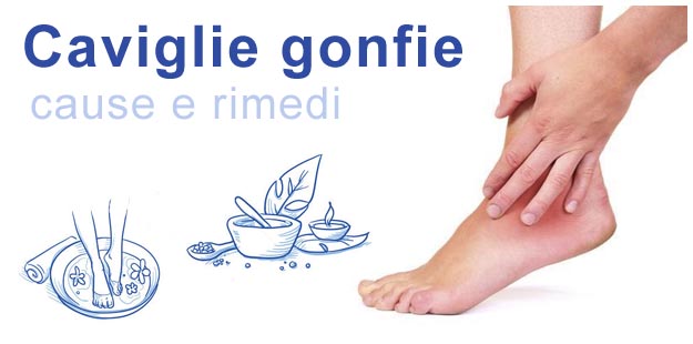 Caviglie gonfie
