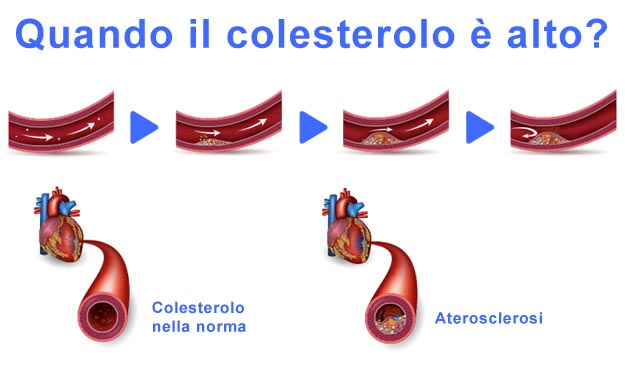 Colesterolo alto