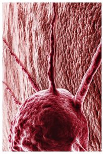 Oncosoppressore p53 nella cura per il tumore Oncosoppressore p53 nella cura per il tumore