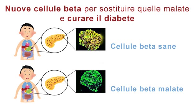 Nuove cellule beta per curare il diabete Cellule beta sane e malate
