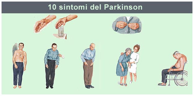 Alcuni sintomi del Parkinson