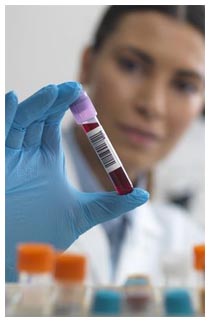 Esame del sangue per diagnosi tumori Provetta per un esame del sangue