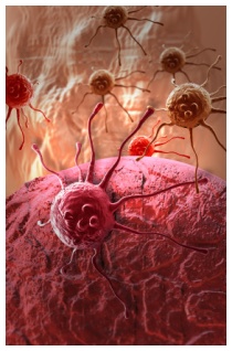 Molecola antitumorale per bloccare le neoplasie Molecola antitumorale per bloccare le neoplasie