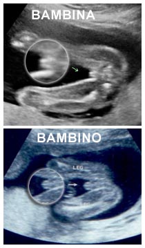 Capire dall'ecografia se è maschio o femmina Ecografia di un bambino e di una bambina