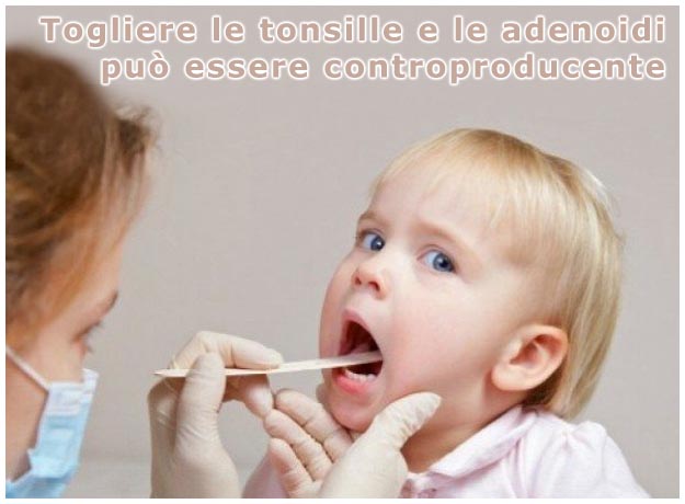 Togliere le tonsille e le adenoidi può essere controproducente Togliere tonsille e adenoidi