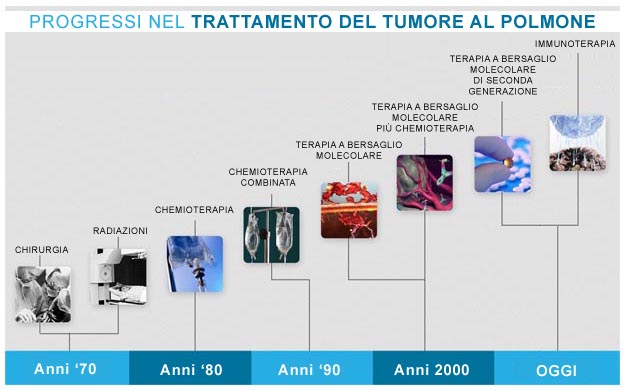 Progressi nella cura del tumore al polmone