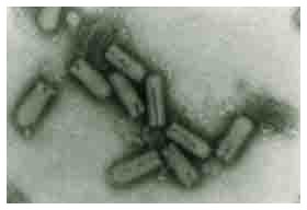 Nuovo vaccino contro l'AIDS