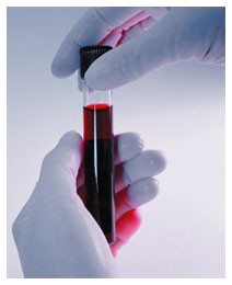 Aids: per il vaccino serviranno ancora 4-5 anni Aids: per il vaccino serviranno ancora 4-5 anni