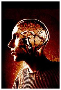 Alzheimer: sintomi in regressione