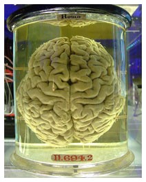 Alzheimer e Herpes Simplex, un possibile legame