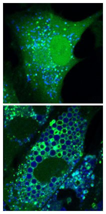 Alzheimer e Parkinson, una possibile terapia