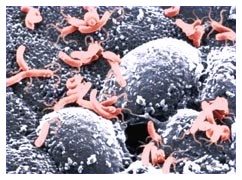 Il batterio dell'ulcera: Helicobacter pylori