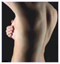 Cancro alla mammella: diagnosi precoce Cancro alla mammella: diagnosi precoce
