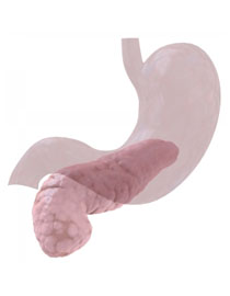 Carcinoma del pancreas: una possibile cura Carcinoma del pancreas: una possibile cura
