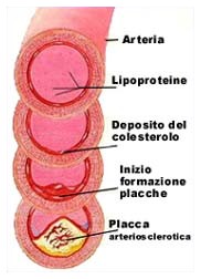 Colesterolo cattivo? problemi genetici