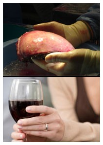 Danni al fegato: una cura per quelli causati da epatite e alcol Danni al fegato: una cura per quelli causati da epatite e alcol