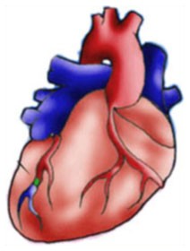 Infarto: prevenire i danni Infarto: prevenire i danni