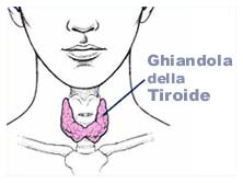 Ipertiroidismo e morbo di Graves