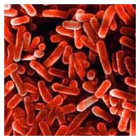 Legionella: Killer silenzioso