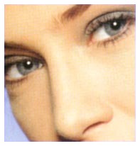 Lupus eritematosus e cure con cellule staminali Lupus eritematosus e cure con cellule staminali