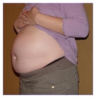 Obesit e sindrome metabolica: Rimonabant