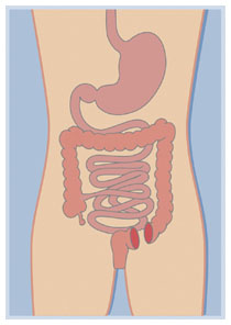 Screening colon retto: diagnosi precoce dei tumori