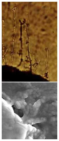 microbi vetrofagi