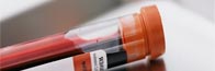 Analisi del sangue
